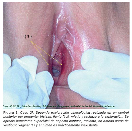 Vaginas that are hairy Vaginas that are black Vaginas with giant pulsing