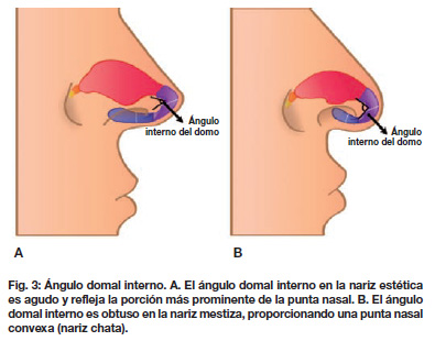 rinoseptoplastia tecnica quirurgica pdf