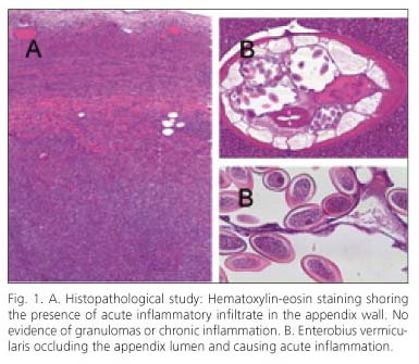 Enterobius vermicularis tudományos cikk