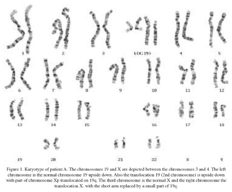 chromosomal abnormalities pictures