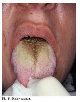 Yellowish Lesions Of The Oral Cavity Suggestion For A Classification