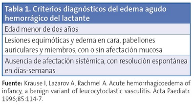 Tabla 1. Criterios diagnósticos del edema agudo hemorrágico del lactante