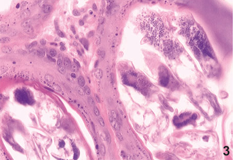 Figura 3. Los parásitos intrafoliculares. En el margen superior derecho se aprecia un parásito casi completo. H-E. 400x.
