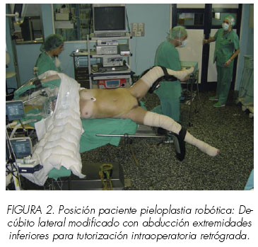 Tecnica Quirurgica Prostatectomia Radical Pdf