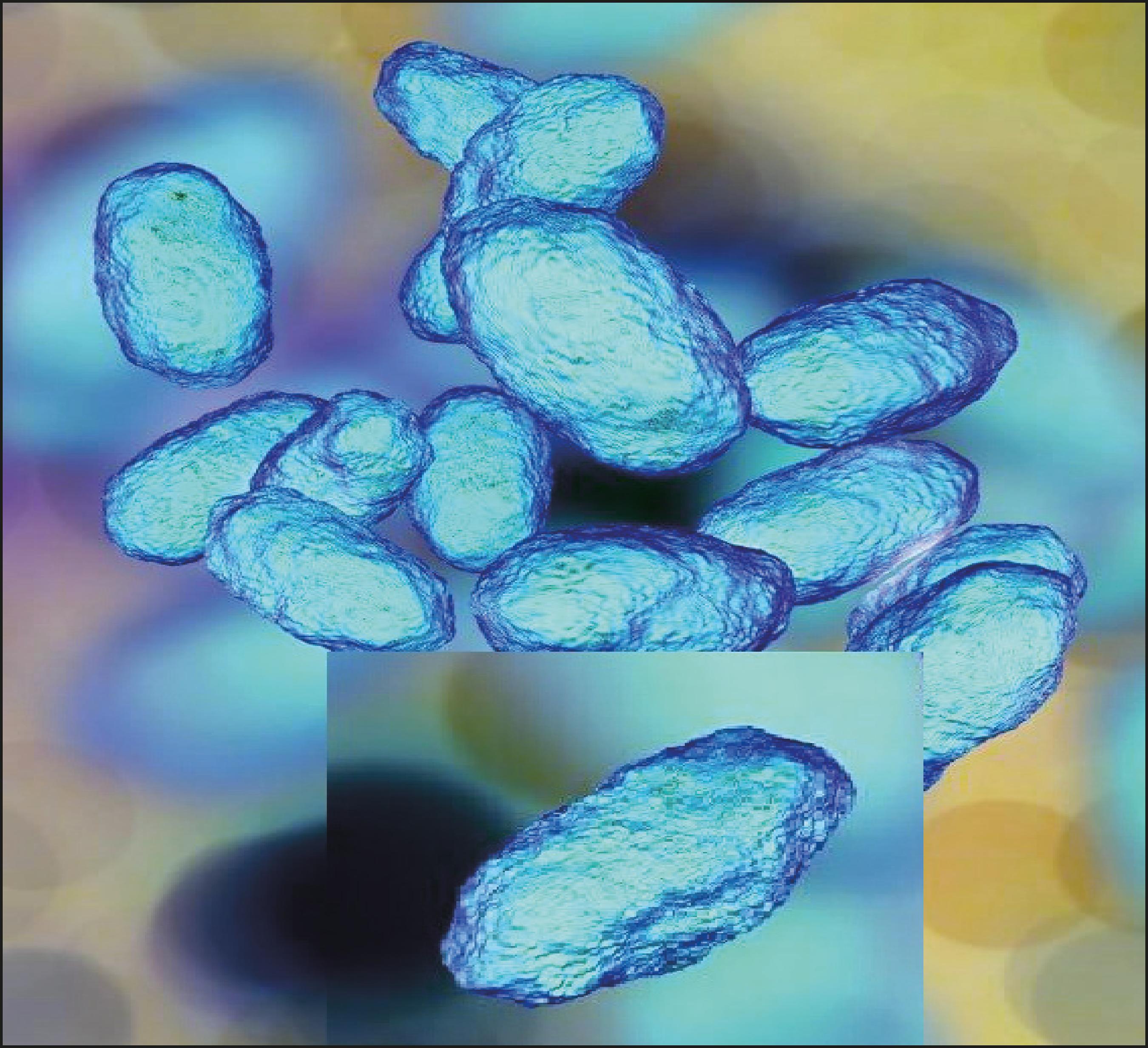 Infección de prótesis mamaria por Haemophilus influenzae