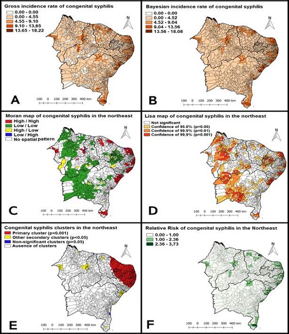 Spatiotemporal Distribution And Factors Related To Congenital Syphilis ...