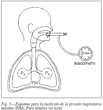 Consecuencias clínicas de la disfunción muscular en enfermedad pulmonar obstructiva crónica