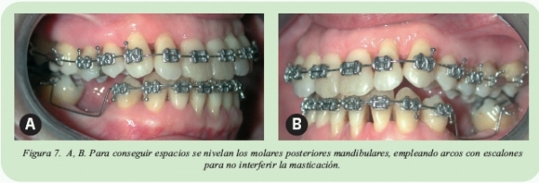 Resolucion de Problemas Clinicos en Ortodoncia y Odontopediatria, PDF, Ortodoncia