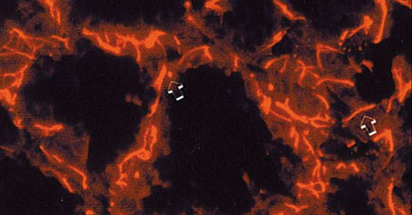 Figura 2. Expresión de la citoqueratina 5 en glándula mamaria de ratón durante la 3.<sup>a</sup> semana de lactación. Tinción de las células mioepiteliales
