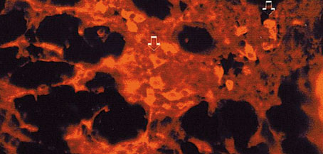 Figura 4. Expresión de la citoqueratina 7 en una pequeña cantidad de células de la glándula mamaria en el periodo lactante