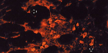 Figura 5. Expresión de la citoqueratina 16 en células aisladas de una glándula mamaria en lactación