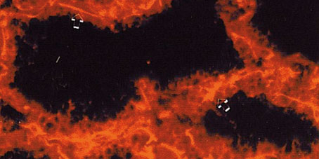 Figura 6. Expresión de la citoqueratina 16 en células aisladas de una glándula mamaria en lactación
