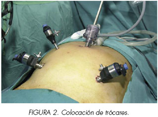 „Performanțele în chirurgia laparoscopică apar în 4-6 ani“